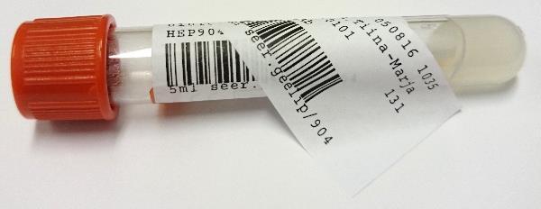pystysuorassa. Näytteen tulee näkyä, joten älä tarroita putkea täyteen!