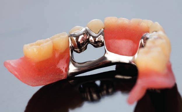 Suomessa vuosittain noin 270 000 henkilöä saa käyttöönsä hammasteknisen tuotteen.