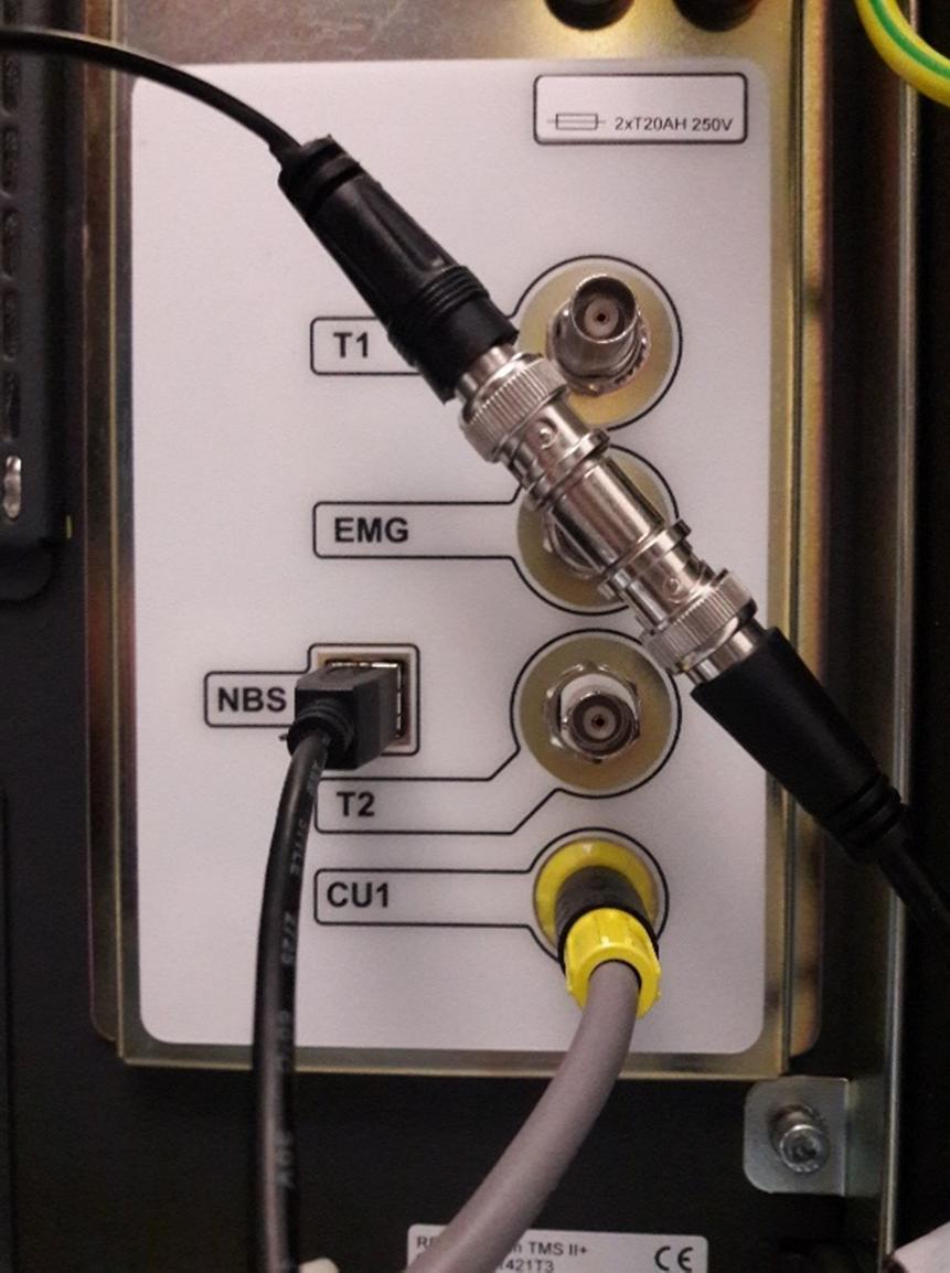 Kiinnitä EEG-laitteen Gate IN -sisäänmenosta (kuva 5.) kaapeli TMS-laitteen EMG-paikassa olevan T-liittimen viimeiseen vapaana olevaan liittimeen. (kuva 6.