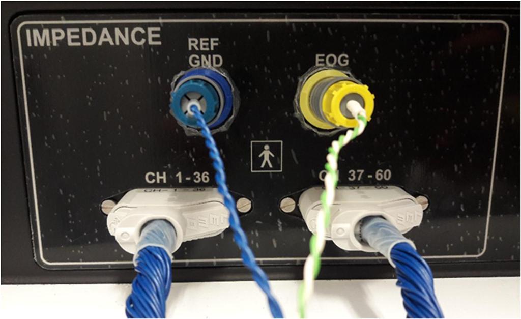 77 (88) Elektrodien kiinnitys ja impedanssien tarkistus - Kiinnitä elektrodimyssyn sekä Ref/G- ja EOG-johdinten liittimet EEG-laitteen kyljen IMPE- DANCE-puolelle. (kuva 10.) KUVA 10.