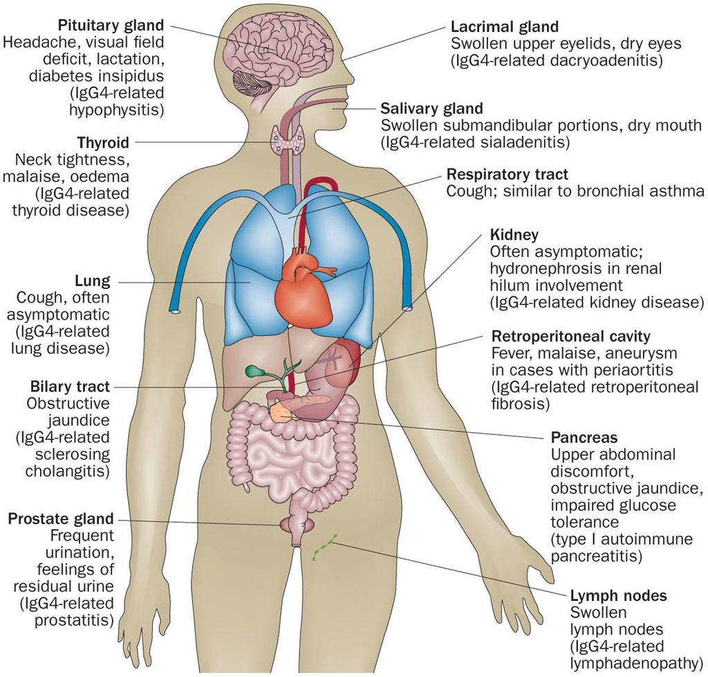 Systemic organ involvement in IgG4-related disease Yamamoto, M. et al.