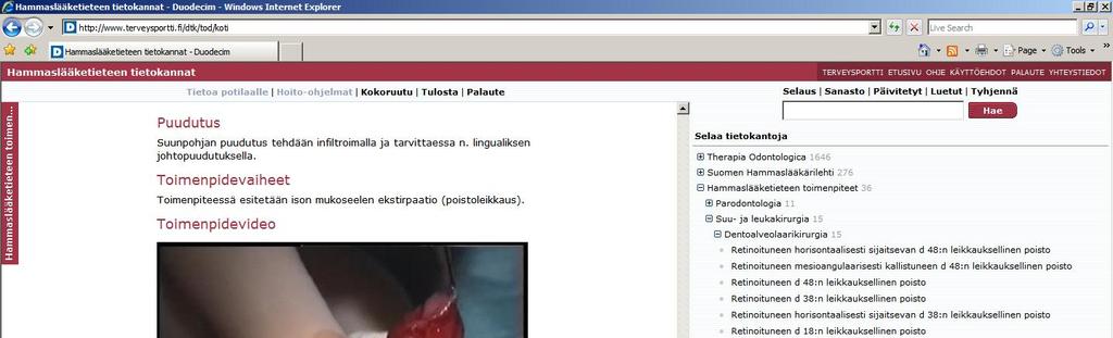 1997 Luu kuuluu potilaalle ja hammas hammaslääkärille 55 56 Distoangulaarisen ja vertikaalisen hampaan paloittelu