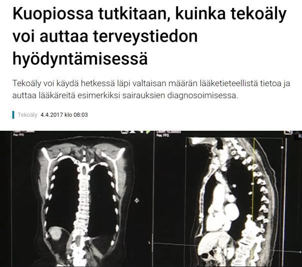 Uusi visio on myös se, että kuvaustietoa ei edes tuotettaisi varsinaisiksi kuviksi lainkaan vaan tekoäly