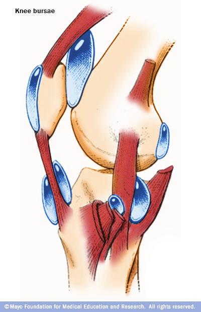 Bursiitit eli limapussintulehdukset
