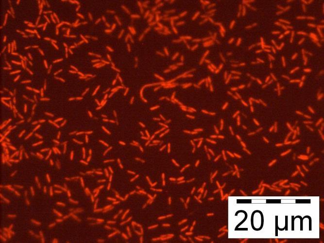 Legionellabakteerit Legionellat ovat luonnon bakteereja Photograph: Markku Lehtola Legionella pneumophila - soluja (PNA-FISHvärjäys) Legionella-sukuun kuuluu vähintään 61 nimettyä lajia ja n.