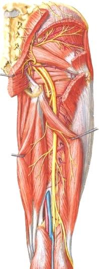 Lihaksia tutkiessasi selvitä: mistä ne saavat hermotuksensa. Reiden ja takapuolen lihaksisto Musculus gluteus maximus, iso pakaralihas M. semi-* tendinosus M. semi-* membranosus M. biceps* femoris M.