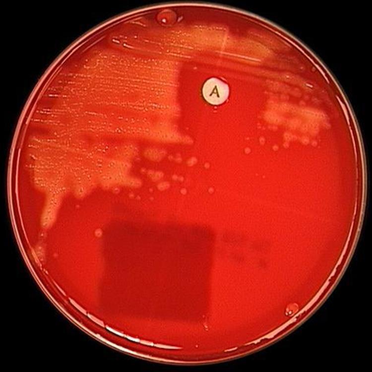 Lyhyt kertaus mikrobiologiaa Streptococcus pyogenes