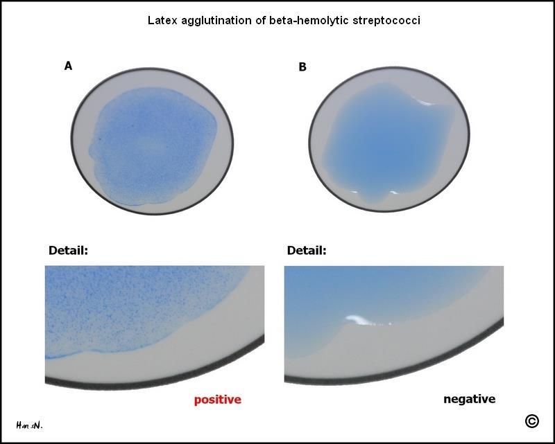 Lancefield luokittelu; soluseinän ryhmäspesisfi polysakkaridi Agglutinaatiotestillä (A, B, C, D, F tai G) A: Streptococcus pyogenes B: Streptococcus agalactiae C: