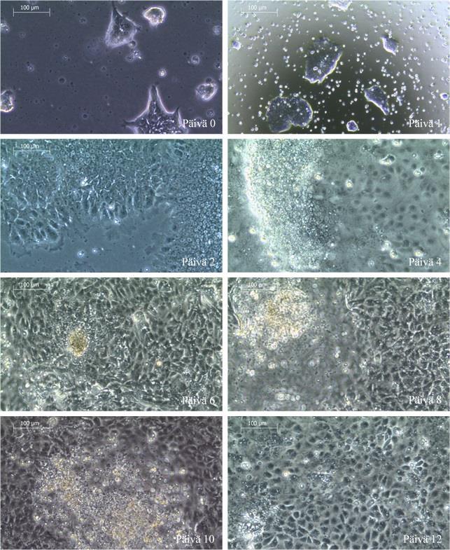 Kuva 10. Trofoblastiprotokollalla viljeltyjä H9-soluja erilaistumassa kokeessa 2. Kymmenkertainen suurennos (10x).