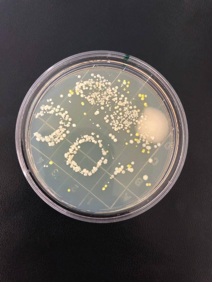 Aallonpituus, nm WiSDOM DS käyttöaika vähenemä log % annos lähde Clostridium difficile 3 min 4,04 log10 >99,99% 36 mj/cm² Rutala W et al. 2010.