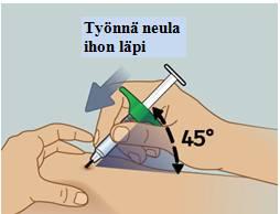 8) Työnnä neula ihon läpi Pidä ruiskua noin 45 asteen kulmassa