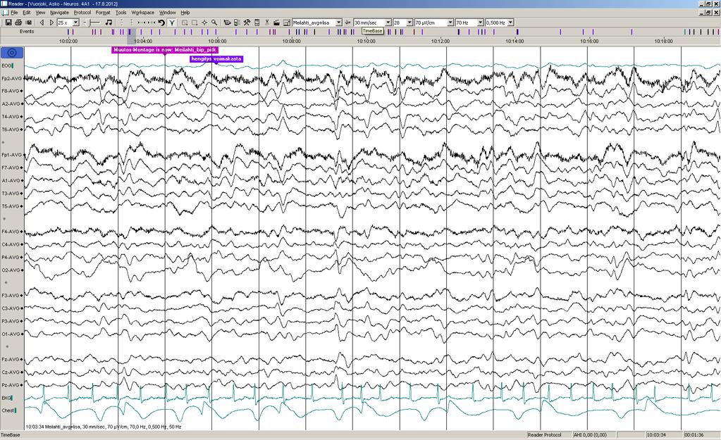 Päiv-EEG-ilmiöitä 1/17: Alareunassa