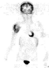 PET-aineet