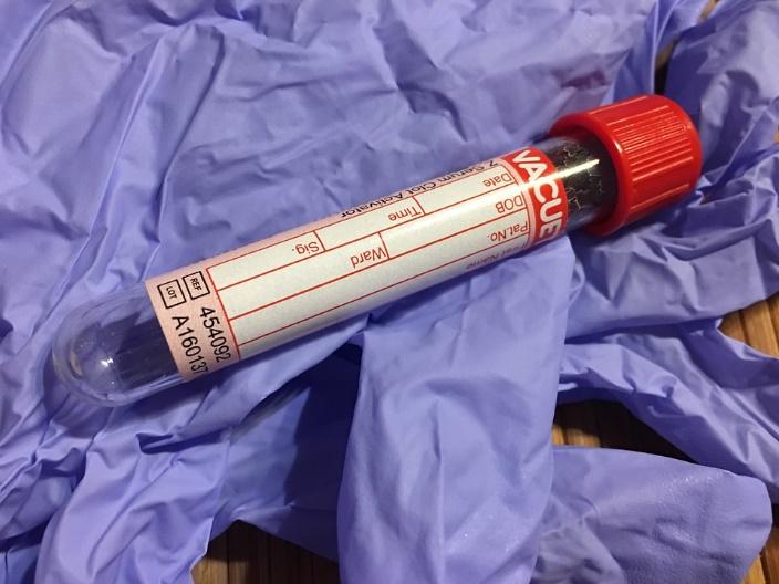 Mahdollisuudet terveyssektorilla Laboratorio diagnostiikka Diagnostisen terveyssektorin liikevaihto kohosi 7 mrd USD.