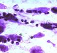 Voge, Medical Parasitology, Saunders 1981, Modifioitu: E. K. Markell ja M.