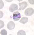knowlesi Aiemmin ajateltiin olevan vain makakiapinoiden ja lehtiapinoiden malaria Kaakkois-Aasiassa Käytettiin 1930-luvulla kupan hoitoon