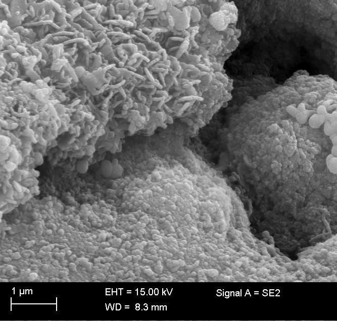 51 Kuva 19. SEM-kuva (mittakaava 1 µm) pilot-kokeiden hiekkasuodattimen toisen rakeen pinnasta. Kuvaaja Mari Honkanen.