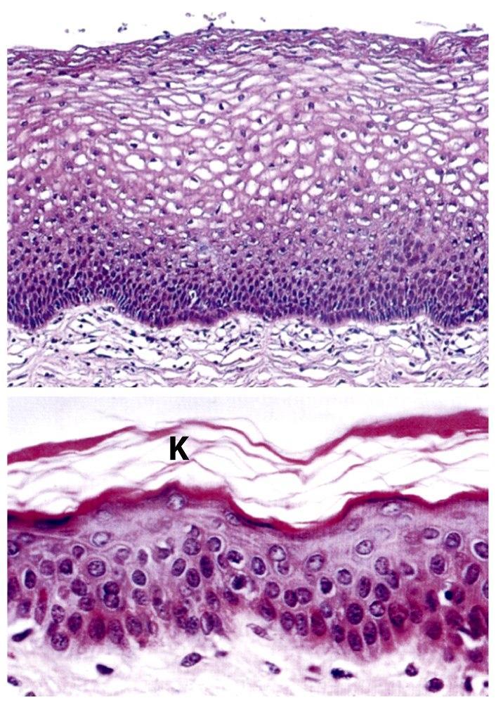 tunnistuskoneistonsa sekä proteaasijärjestelmänsä From Primary Tumor to