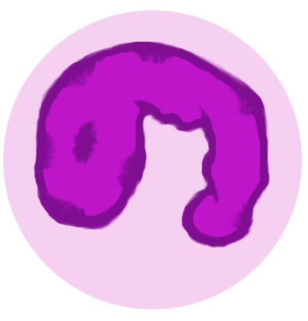 EOSINOFIILI