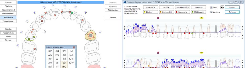 4 / 8 2. PARODONTOLOGISEN STATUKSEN TOIMINNOT 2.1. Parodontologisen statuksen avaus Avaa nykytilastatus. Klikkaa Parodontologia.