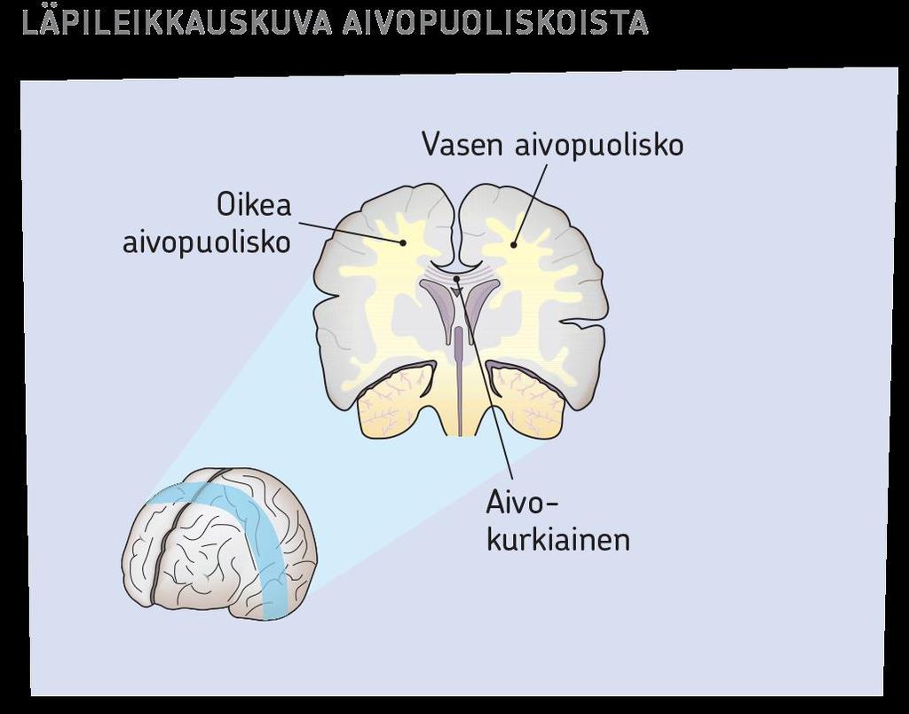 Aivojen lateralisaatio Aivokurkiaisen ansiosta tieto kulkee aivopuoliskosta toiseen.