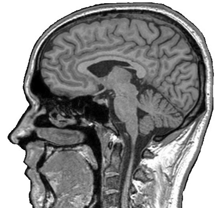 Aivorunko. Pikkuaivot Ja isoaivot Isoaivoja peittää aivokuori eli korteksi.
