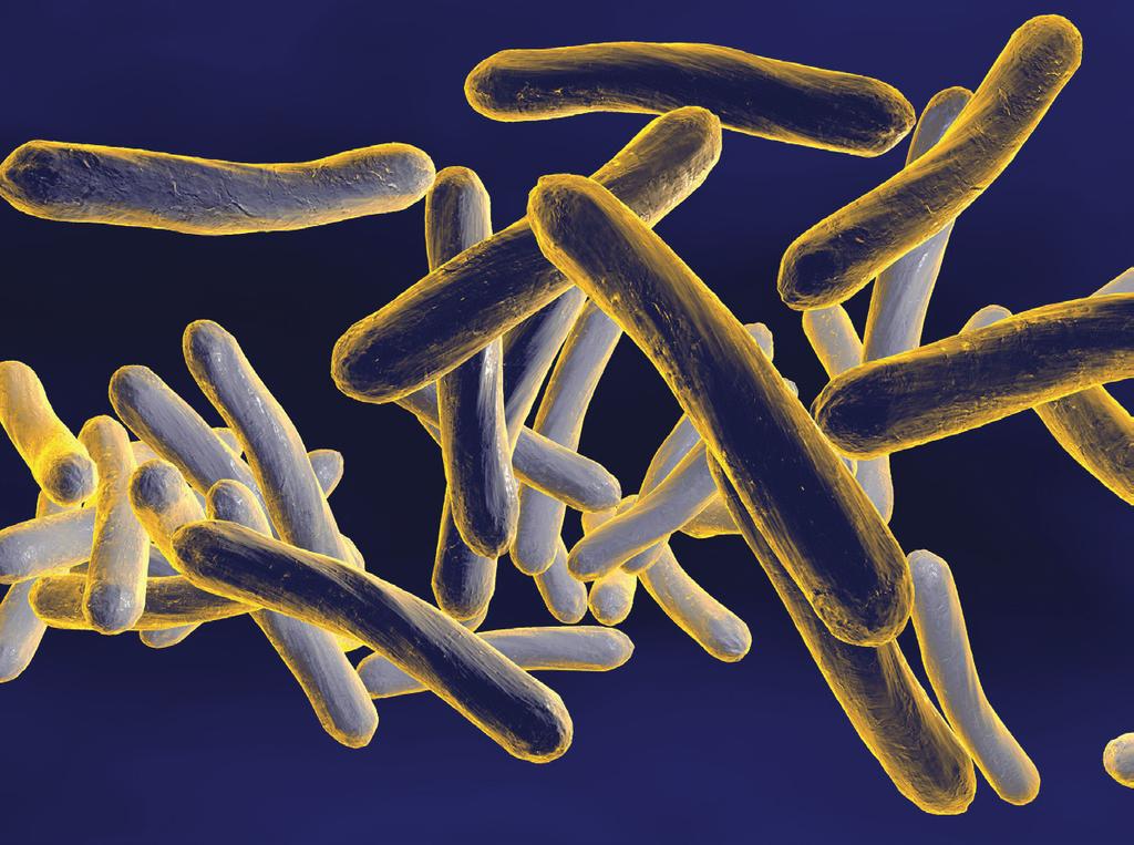 Tuberkuloosi MIKÄ ON TUBERKULOOSI? Tuberkuloosi on Mycobacterium tuberculosis -bakteerin aiheuttama infektio. Tavallisin tuberkuloosin muoto on keuhkotuberkuloosi.