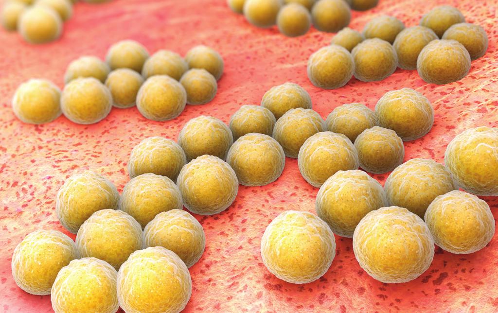 MRSA MIKÄ ON MRSA? Staphylococcus aureus -bakteeri on yleinen bakteeri, jota löytyy terveiden henkilöiden iholta ja nenän limakalvolta. Usein sitä kutsutaan pelkästään stafylokokiksi.