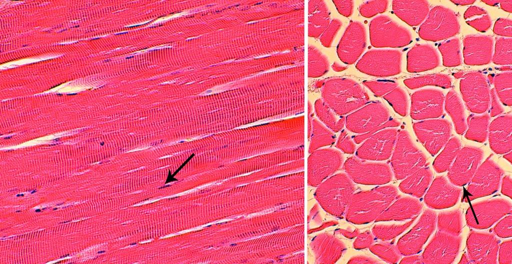 senttimetrin pituisia. Yhden lihassyyn halkaisija voi aikuisella olla 10 100 µm ja pituus joissain lihaksissa jopa 35 cm. Tumat sijaitsevat solussa välittömästi solukalvon alla.