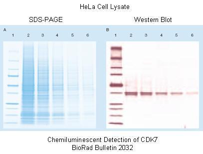 htm Western blot -menetelmän tuloksena vain tutkittava proteiini havaitaan