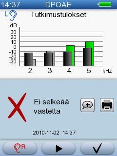 5 AccuScreen-testaus Tutkimuksen kesto Vakio DPOAE Noin 10 sekuntia normaalikuuloisilla lapsilla hiljaisissa olosuhteissa, mutta tutkimusolosuhteet voivat vaikuttaa kestoon merkittävästi. 5.3.