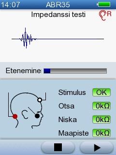 5 AccuScreen-testaus Molempien korvien tutkiminen Kun tutkimus suoritetaan korvakoplereilla, Binauraalinen-painike tulee näkyviin. Painamalla tästä tutkitaan molemmat korvat. 5.4.