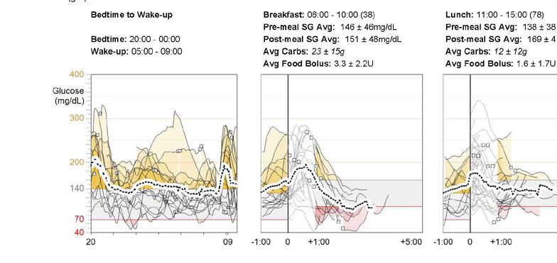 Mitä tummempi alue on, sitä useammin arvosi on ollut alle.9 mmol/l. Toistuvasti esiintyvät hypoglykemiat saattavat näkyä malleina, josta on syytä keskustella lääkärisi kanssa.. Glukoosi 6.7. 7.