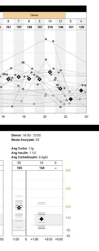 Sensorin ja mittarin yleistiedot -raportti sisältää tietoja insuliinipumpusta, verensokerimittarista sekä glukoosisensorista.