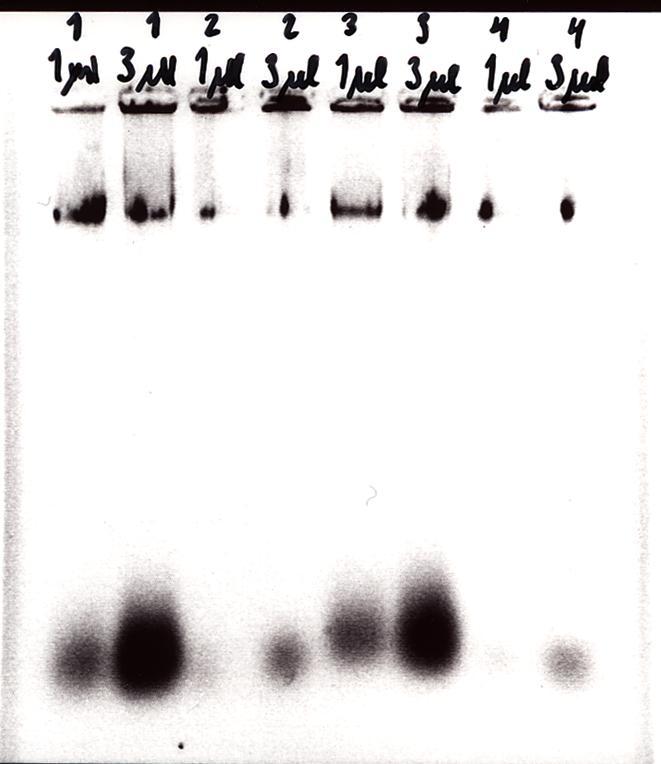 27 5 TULOKSET JA TULOSTEN TARKASTELU Tuloksissa tarkastellaan kosmidikloonauksen ja DNA-kirjaston valmistusta ja sen onnistumista.