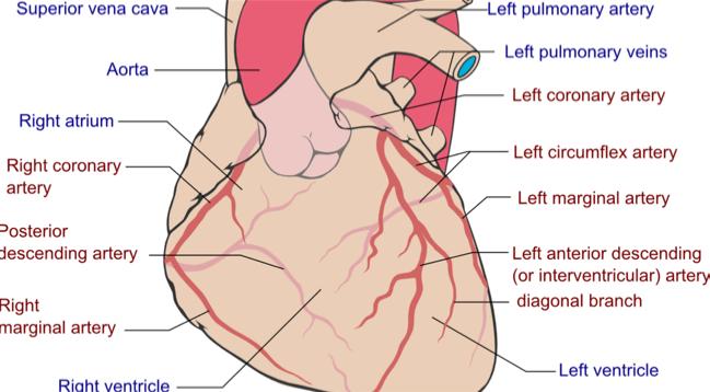 Widow maker coronary artery (LAD)