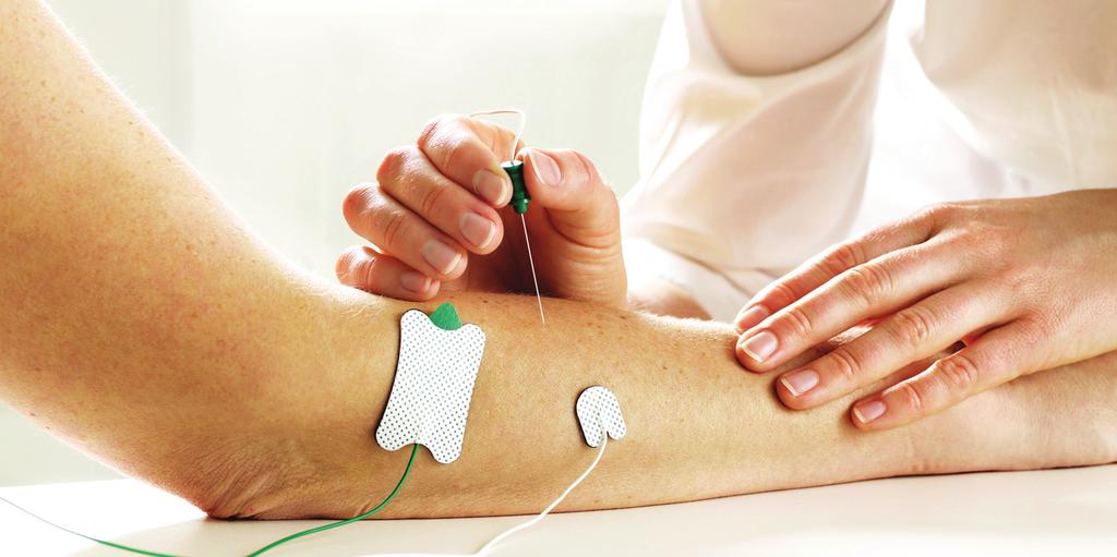 EMG Ambu Neuroline Monopolar potilaskohtainen EMG-neulaelektrodi Ambu Neuroline Monopolar lupaa erinomaista hallintaa ja joustavuutta jokaiseen käyttökertaan.