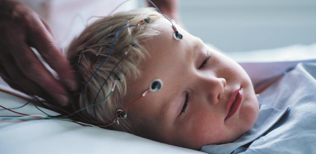 Ideas that work for life EEG Ambu Neuroline Cup Potilaskohtainen EEG/EP kuppielektrodi Potilaskohtainen Ambu Neuroline kuppielektrodi takaa aina 100%:n tasaisen signaalin laadun.