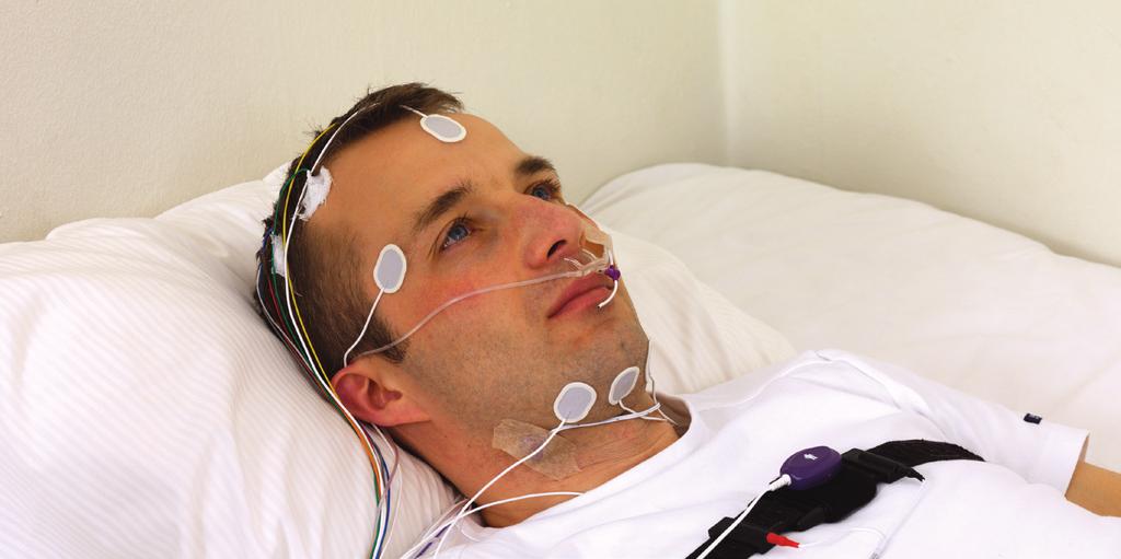 Pintaelektrodit kasvoille Ambu Neuroline 720 Sopivat käyttötarkoitukset n Polysomnografia (PSG) n Intraoperatiivinen valvonta (IOM) n Elektroenkefalografia (EEG) n Herätepotentiaalit (EP) Ambu