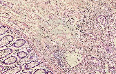 tieteellinen tutkimus tieteellinen jatkokoulutus Lääketieteen erikoisala Erikoisala, jonka piiriin kuuluvat taudin diagnosointiin tähtäävät kudosten