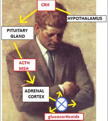 Addisonin tauti Diagnostiikka: S-kortisoli, P-ACTH (poissulje ALD/ VLCFA; APS1/DNA ja AIT-endo) Hoito: Akuutisti: HC