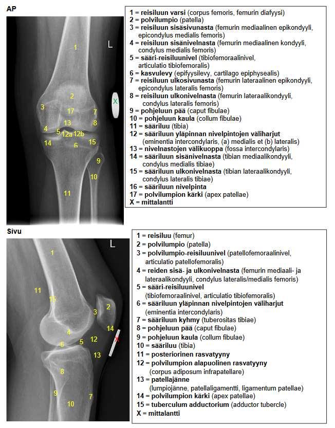 17 Kuva 1: Polven luiset rakenteet, natiiviröntgen (HUS 2016) 6.1.1 Polvilumpiojänne Polvilumpio (lig. patellae) on melkein kolmionmuotoinen luu joka on sulautunut nelipäisen reisilihaksen jänneosaan.