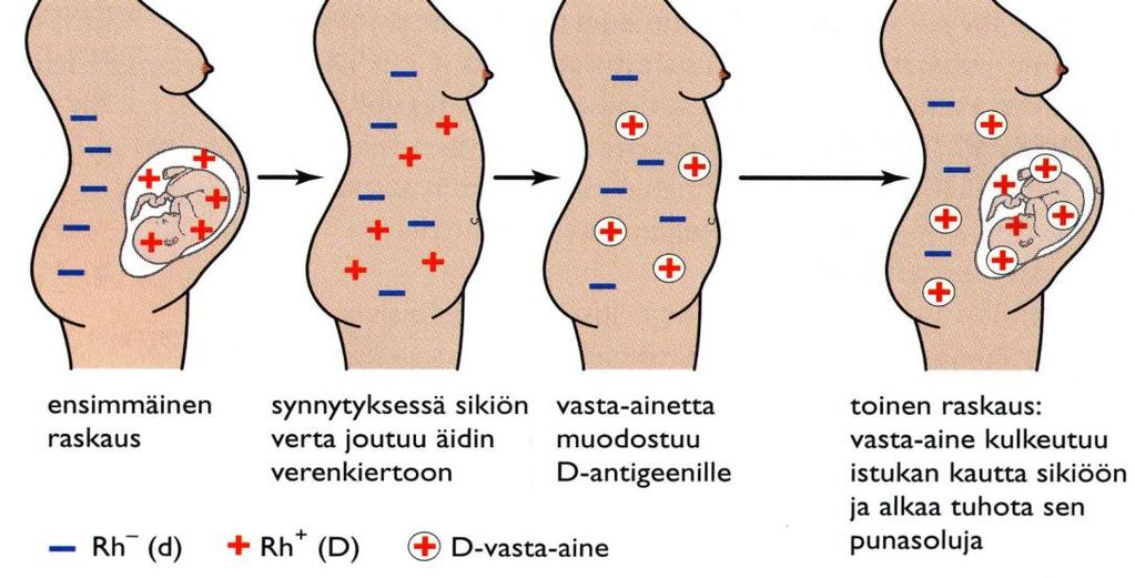 Reesustekijä RH-positiiviset (85% eurooppalaisista): punasolun pinnassa