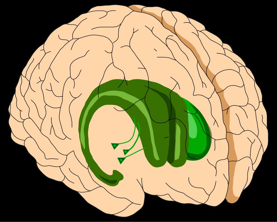 menetetty substantia nigrasta, ja arviolta 70% hermosäikeistä on