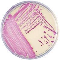 Sisältävät kefoksitiiniantibioottia, minkä takia sille herkät bakteerit (esim. herkkä S.