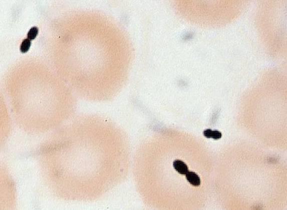 Enterokokit Suoliston normaalimikrobistoa E. faecalis, E. faecium Taudinaiheuttamiskyky varsin vähäinen, ns.