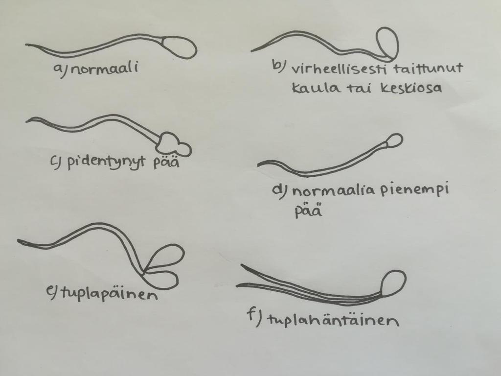 KUVA 1. Kuva normaaleista ja epänormaaleista siittiöistä (Mukaillen Bras, Lens, Piederiet, Rijn-ders, Verveld & Zeilmaker 1996, 49). Kuvassa 1 näkyy normaali ja epänormaaleja siittiöitä.