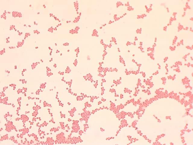 Megasphaera M. cerevisiae, M. paucivorans, M. sueciensis gram-negatiivisia kokkibakteereita ph:n oltava yli 4 ja inhiboituvat, jos alk.