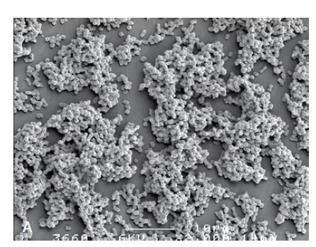 Biofilmin muodostuminen Biofilmi = järjestäytynyt, elolliseen tai elottomaan pintaan kiinnittynyt, useita lajeja sisältävä mikrobiyhteisö mikrobien luonnollinen elämäntapa esiintyy luonnostaan