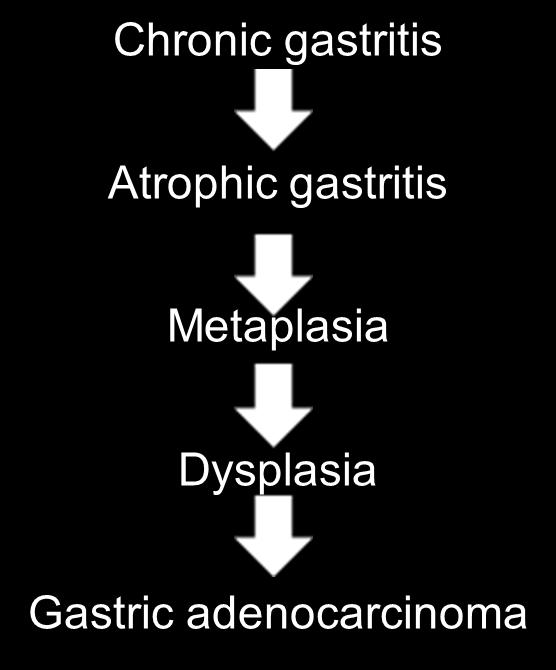 carcinoma in humans (Correa 1992) Examples in humans Barret s esophagus (Singh et al.